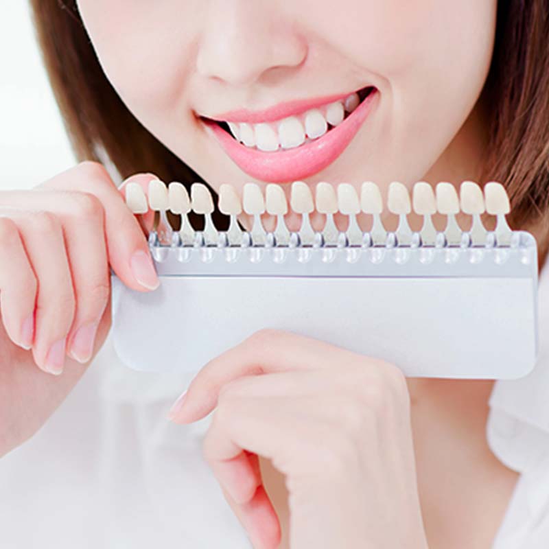 ホワイトニング