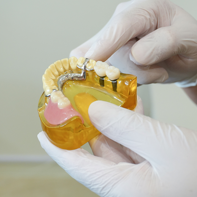 予防・かみ合わせに注力